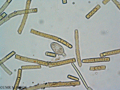 phyto/Mayotte/dziani/DZIANI 2007-2016/Lacrymaria sp(copy)_thumb.jpg